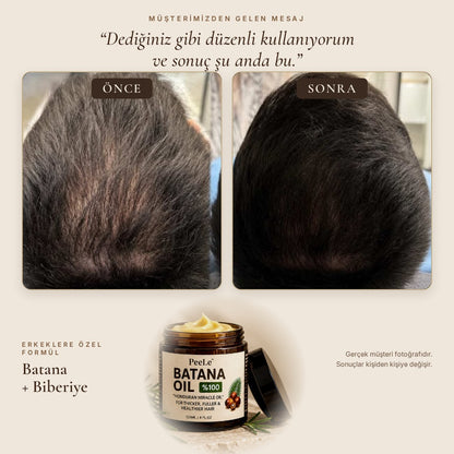 Batana Erkek – Saç Bakım Yağı 120 ml