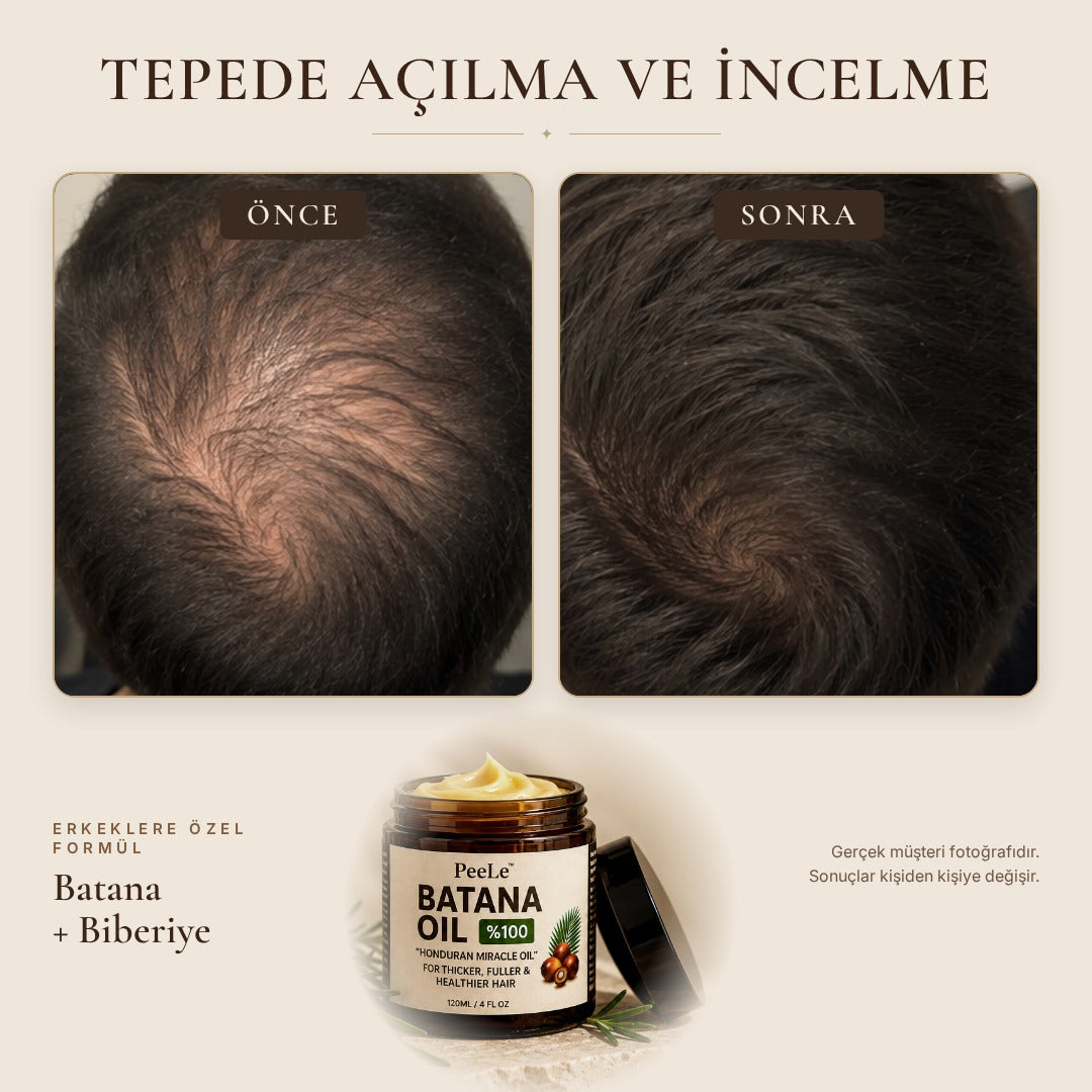 Batana Erkek – Saç Bakım Yağı 120 ml
