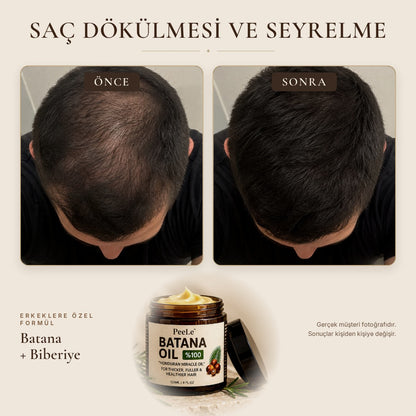 Batana Erkek – Saç Bakım Yağı 120 ml