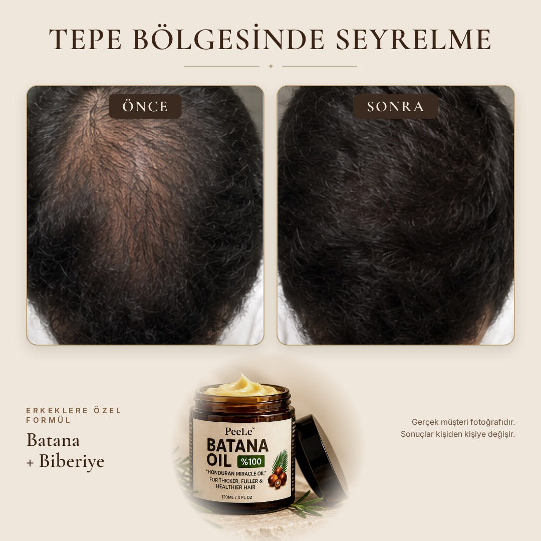 Batana Erkek – Saç Bakım Yağı 120 ml