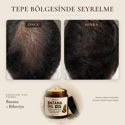 Batana Erkek – Saç Bakım Yağı 120 ml