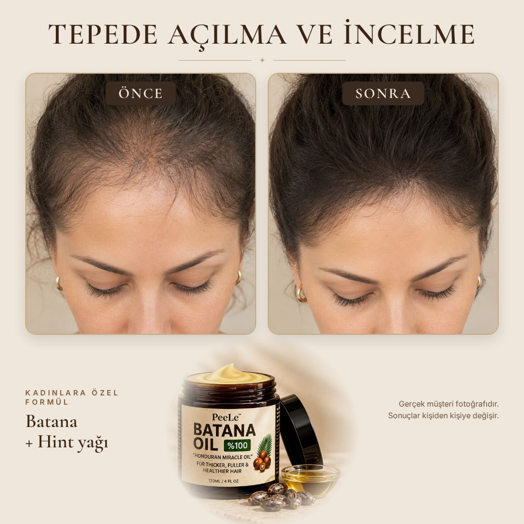 Batana Kadın – Saç Bakım Yağı 120 ml