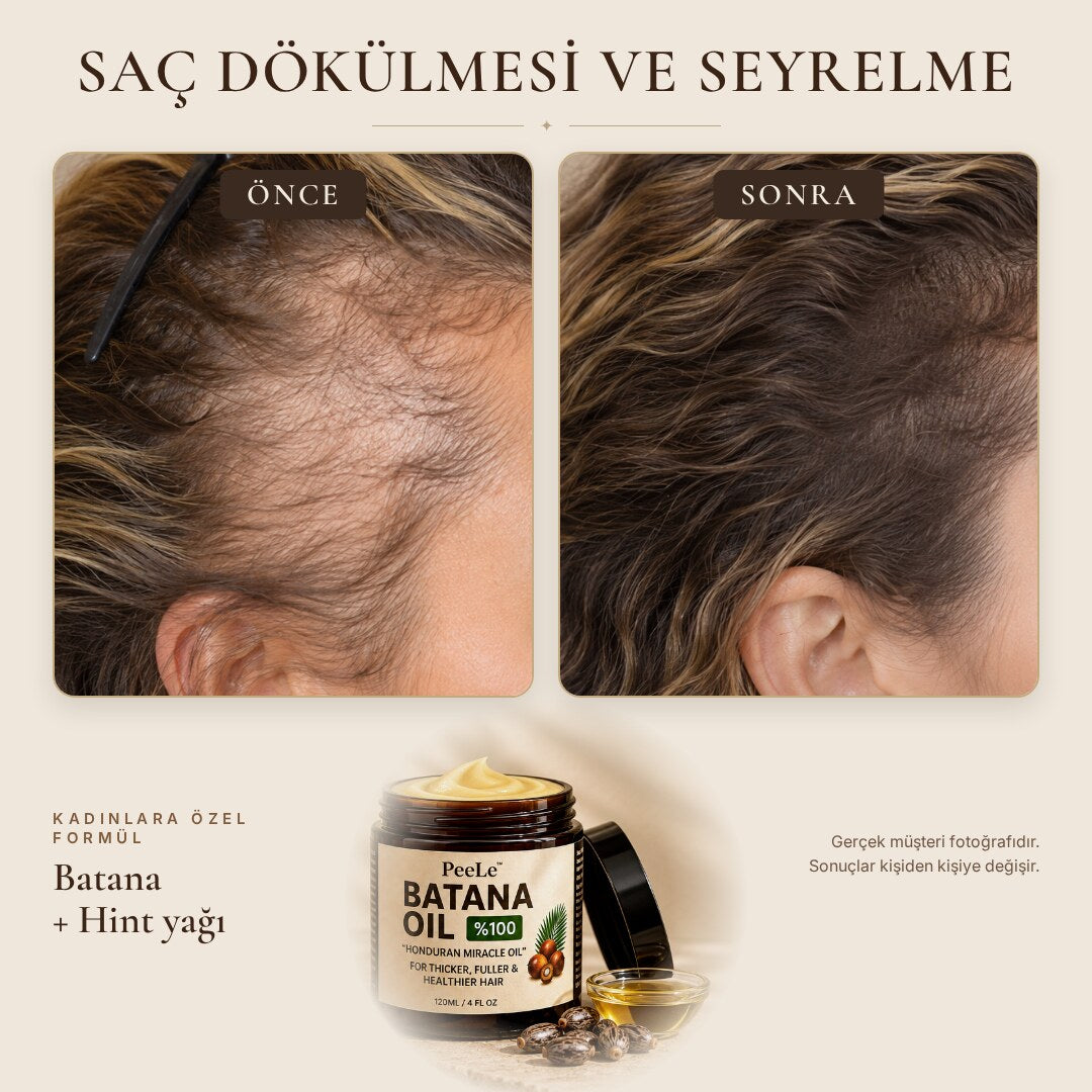 Batana Kadın – Saç Bakım Yağı 120 ml