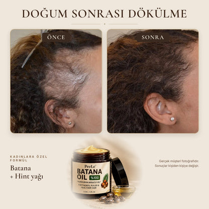 Batana Kadın – Saç Bakım Yağı 120 ml